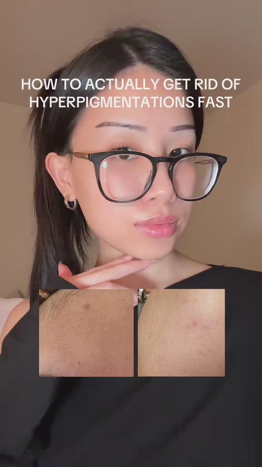 Topicals Faded Serum for Dark Spots